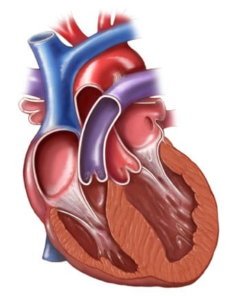 Coronal Section of the Heart by Jennifer Fairman, CMI, FAMI 