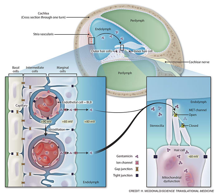 Antibiotic route to the cochlea by Heather McDonald 