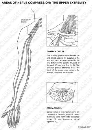 Nerve Compression Syndromes by Erica Beade 