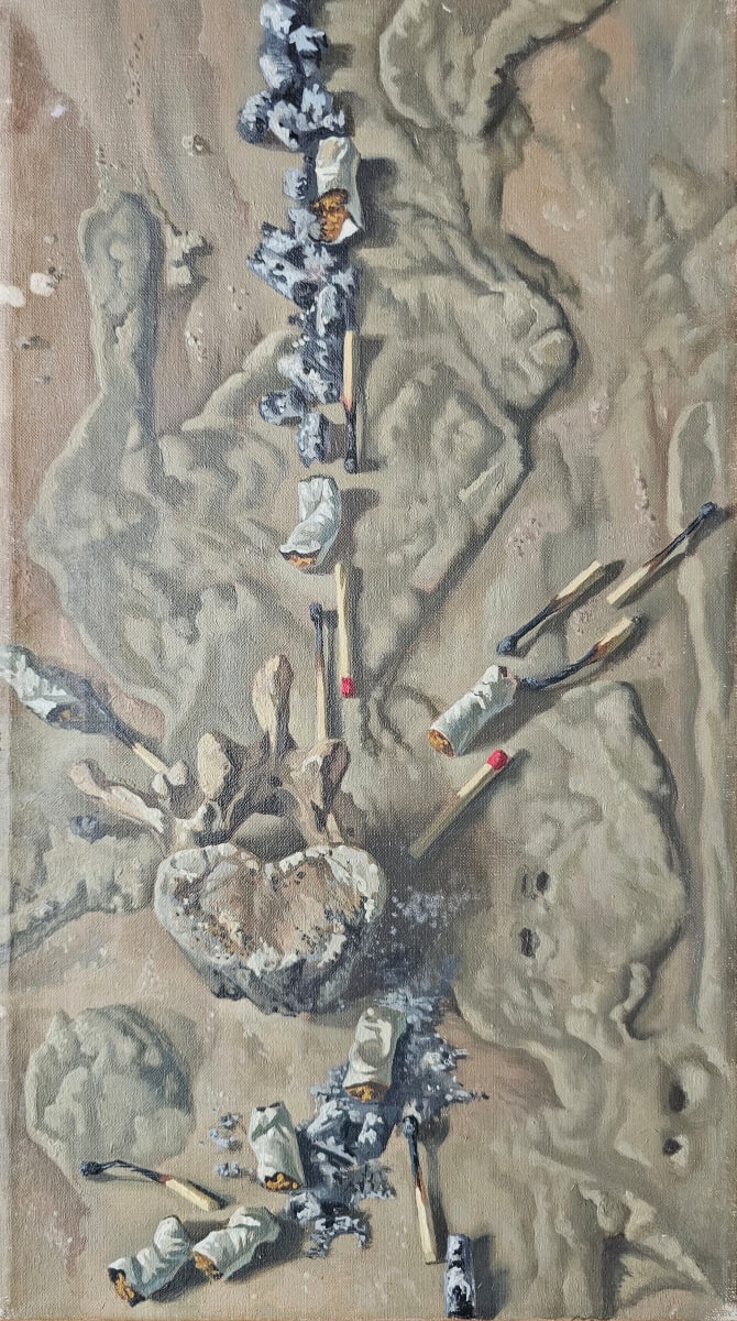 Zenuwknoop by Albertus Gerardus Knupker 