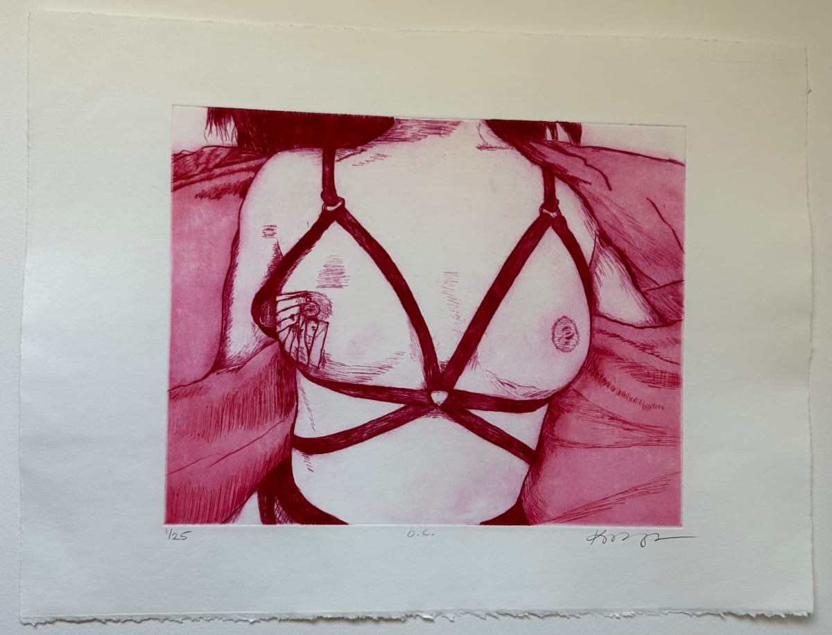 B.C. by kayla tange  Image: Red ink intaglio print of my body after breast cancer and endometriosis surgery. Etching based on a photo taken by Luka Fisher
