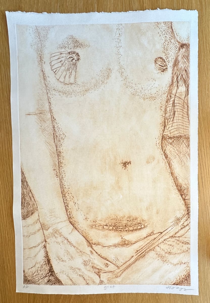 Grief / Sepia / AP by kayla tange  Image: Sepia ink intaglio print of my body after breast cancer and endometriosis surgery. 