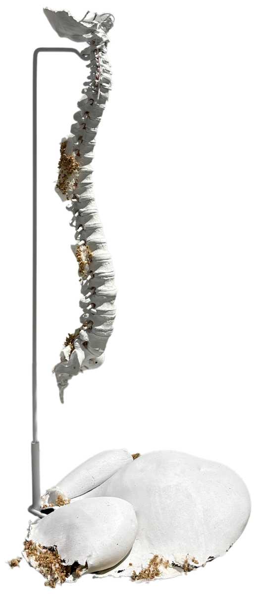 The atlas bone by Madyha J. Leghari, Image 1.