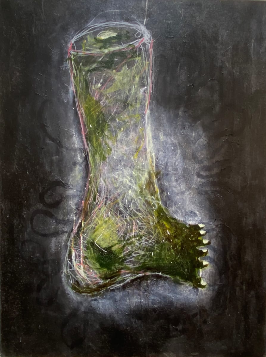 Her Gangrene Foot by Timothy Nero Studio, Image 1.