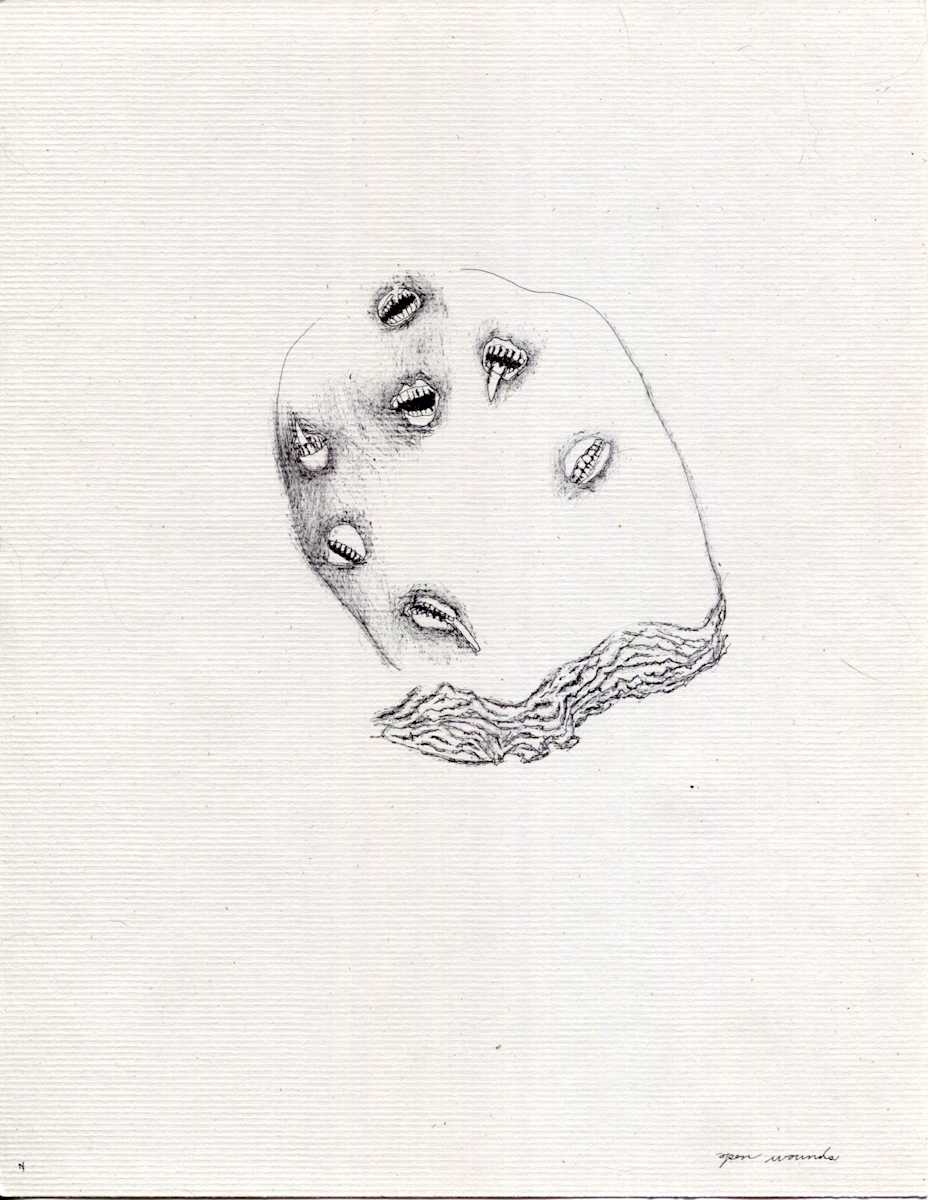 Open Wounds by Timothy Nero Studio, Image 1.