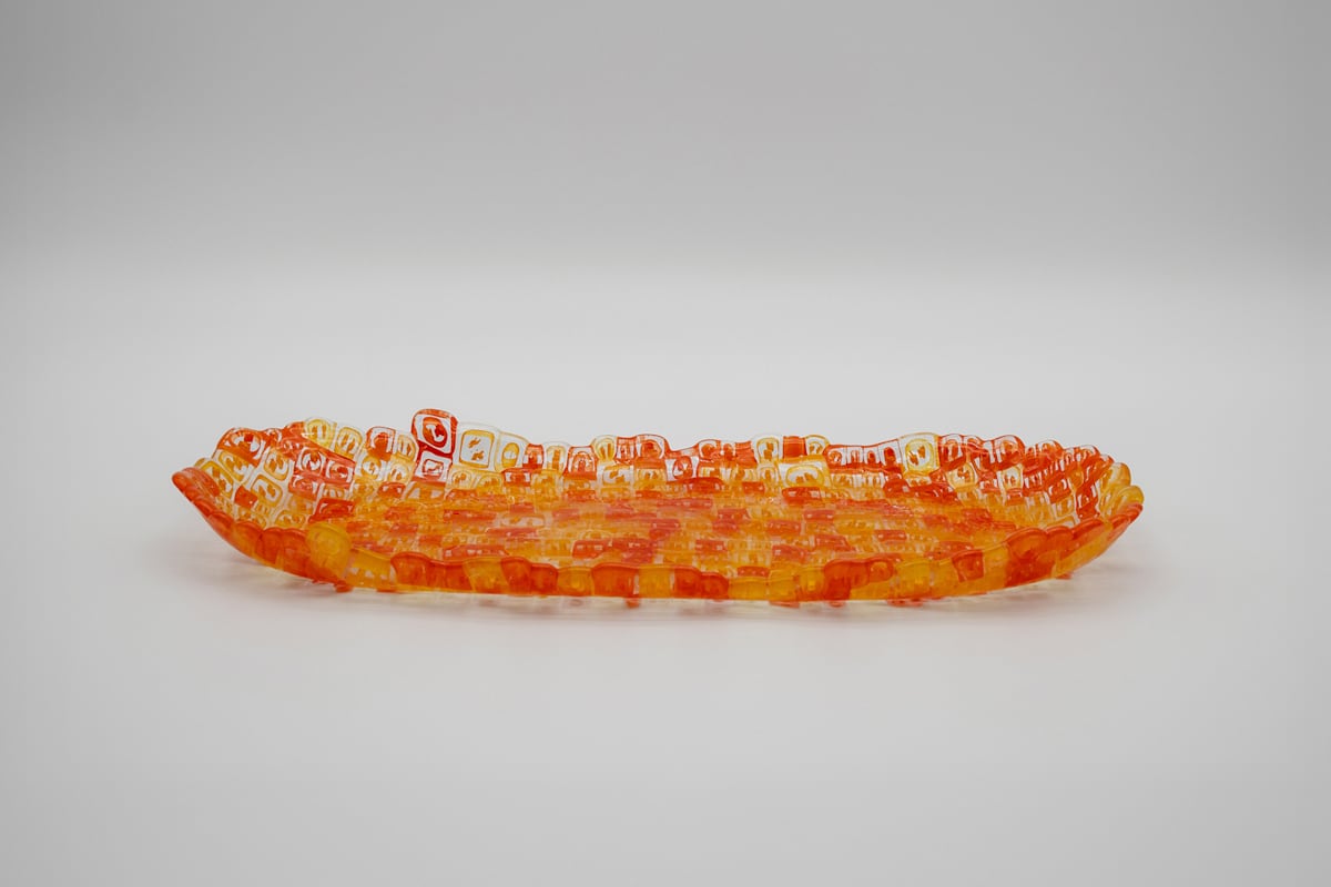 Turner Syndrome by Kim Harty 