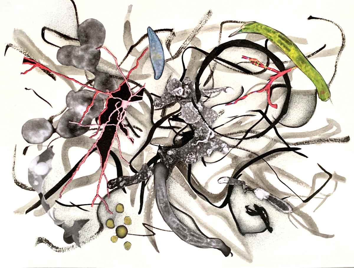 Brains 1915 by Julie Harrison, Image 1.