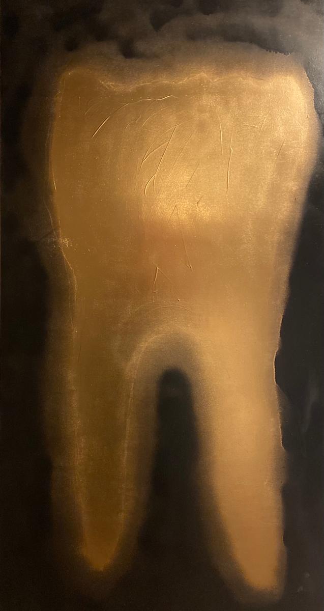 Gold Tooth by Michelle Mullet, Image 2.