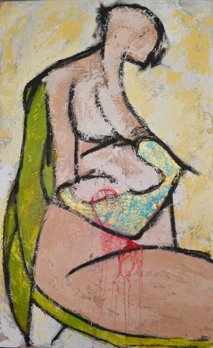 The Miscarriage by Pedrin Garcia, Image 1.