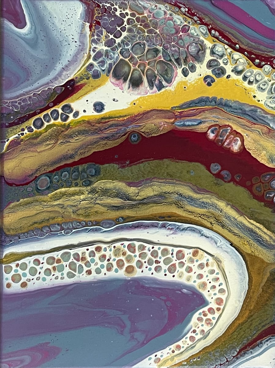 Freckles by Beth Miller 