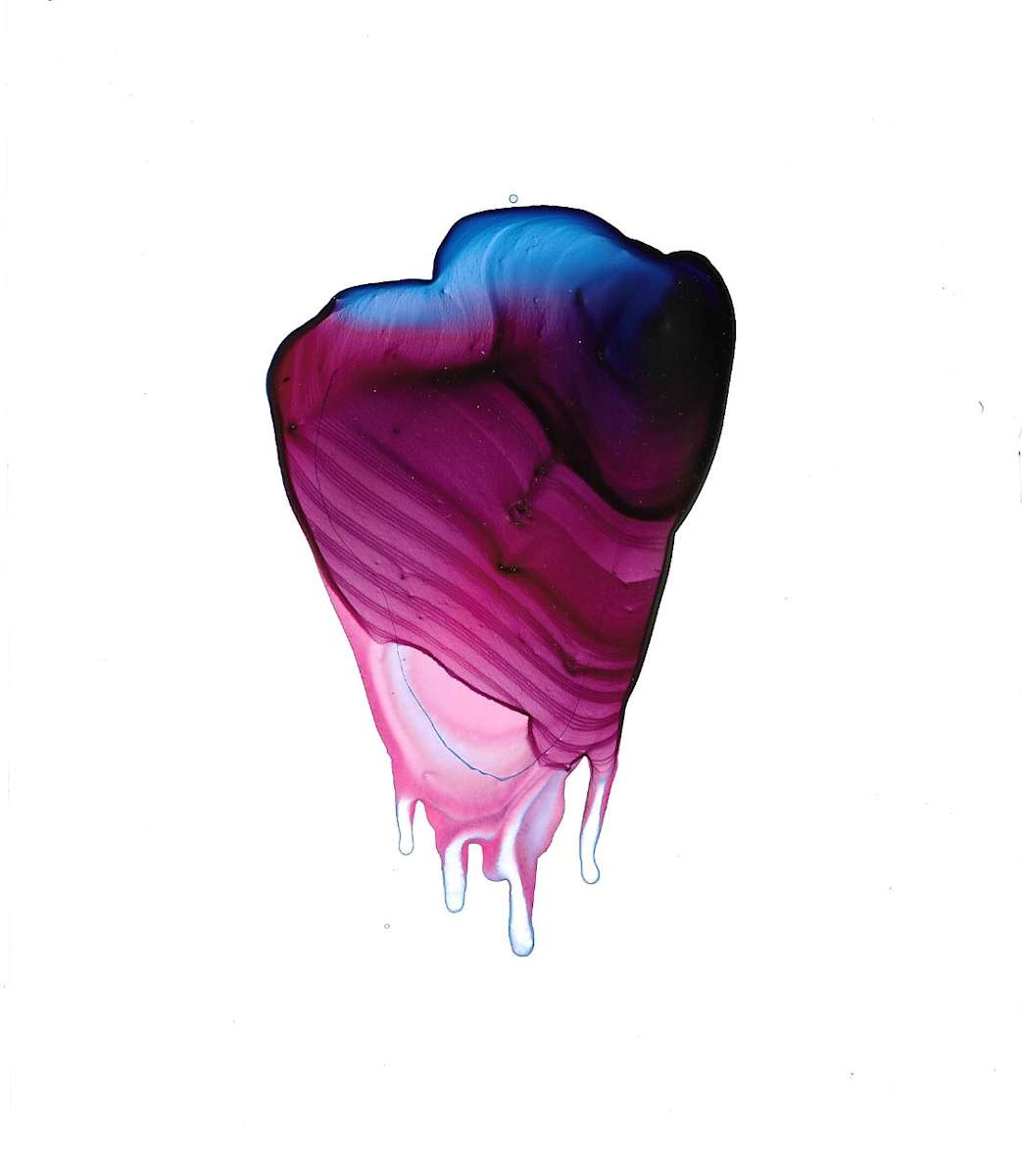 Swollen Heart by Caitlin G McCollom, Image 1.