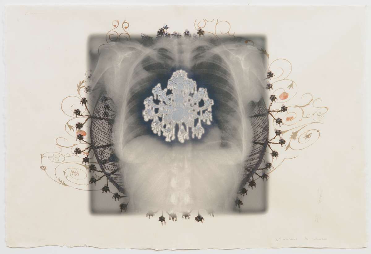 Inhale Series (horizontal/orange chandelier) by April Vollmer  Image: x-ray torso with silkscreen silver chandelier inside and radiating orange chandelier outside (from Guanjuato images)