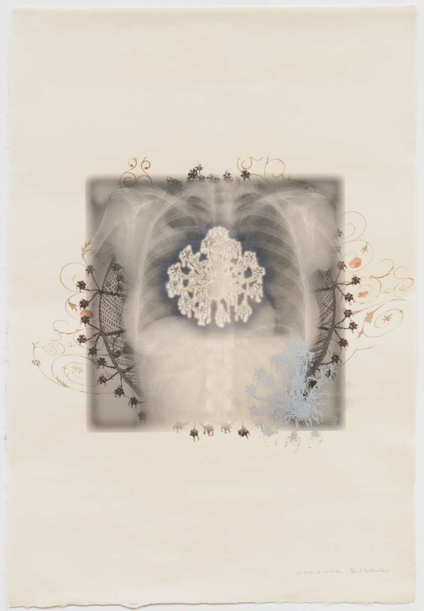 Vertical Inhale (with orange chandelier) (ed 3) by April Vollmer  Image: Inhale envisioned as light, with a small chandelier inside the torso and large orange one behind, overprinted with silver silkscreen