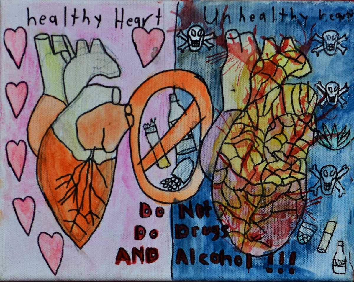 The Dangers of What Happens to Your Heart (It Becomes Terrible) by Matt Nakuyana 