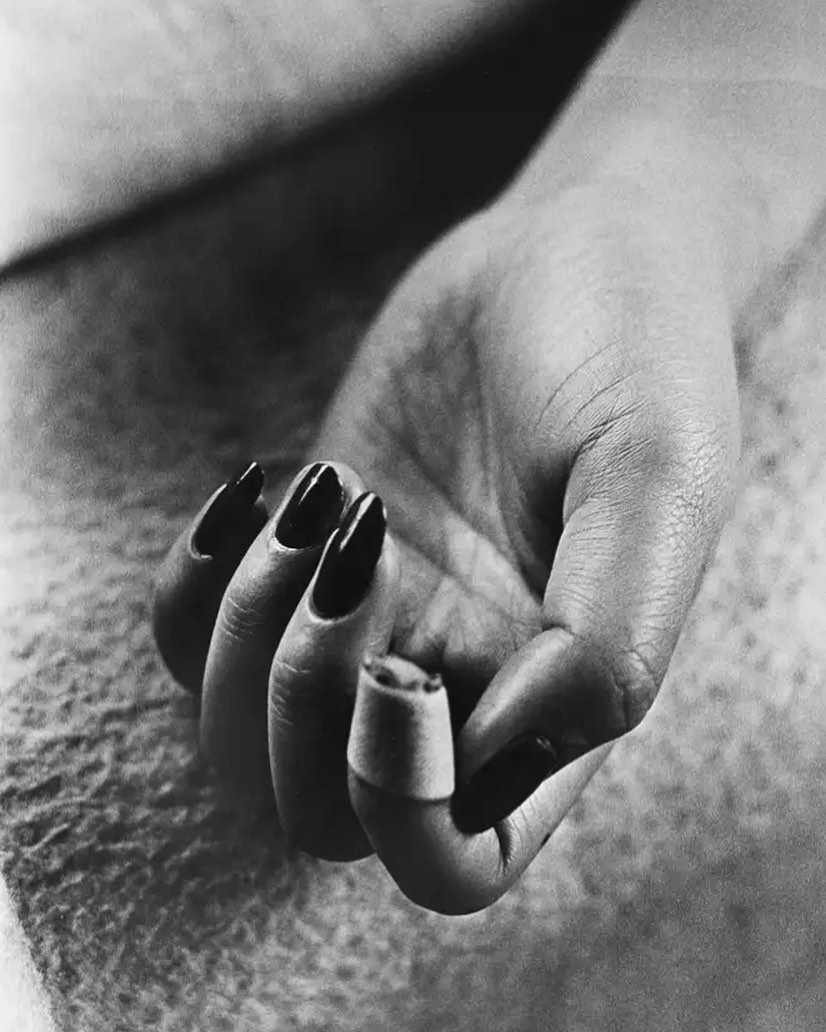 Bandaged Finger by Daido Moriyama, Image 1.