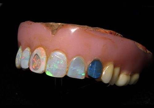 Opal Dentures by Harold Hodges 