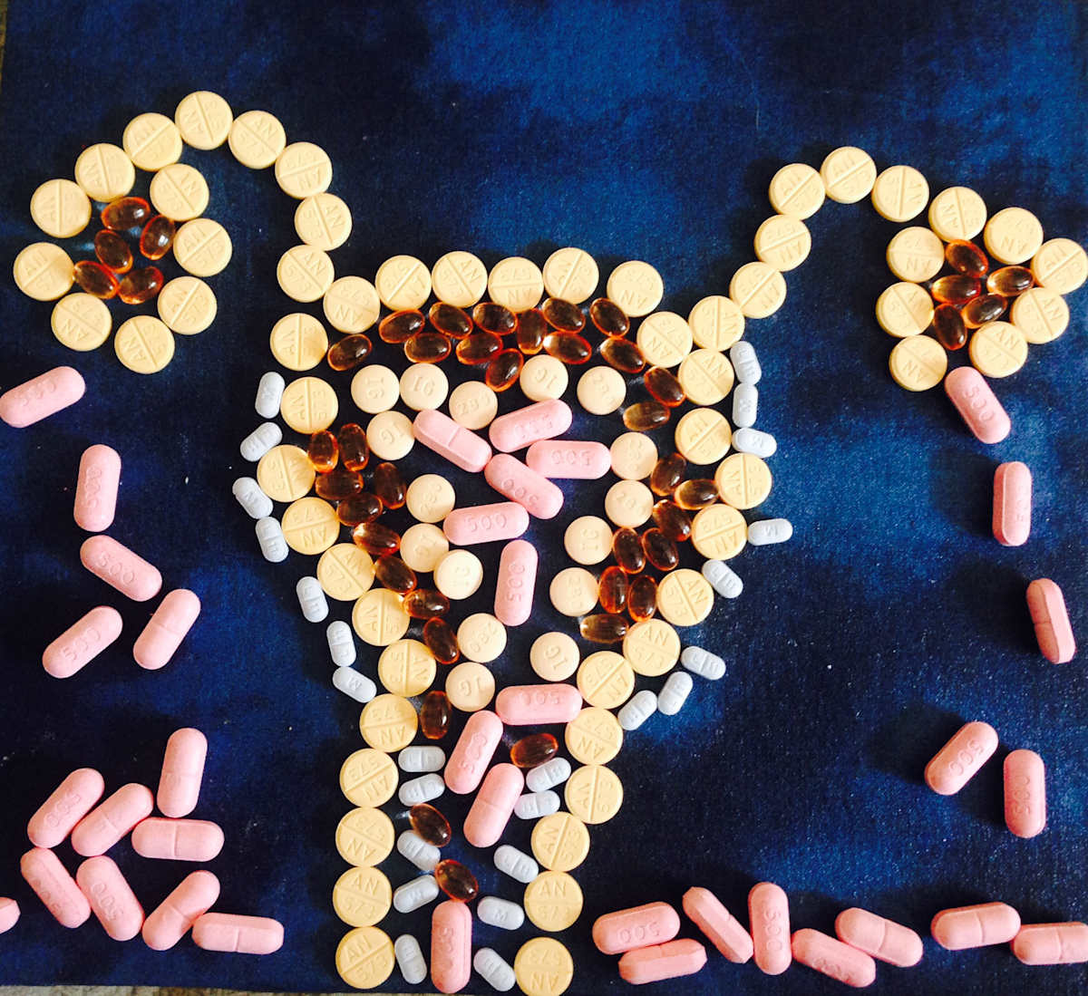 Ovarian pills by Jennifer C.  Pierstorff, Image 1.