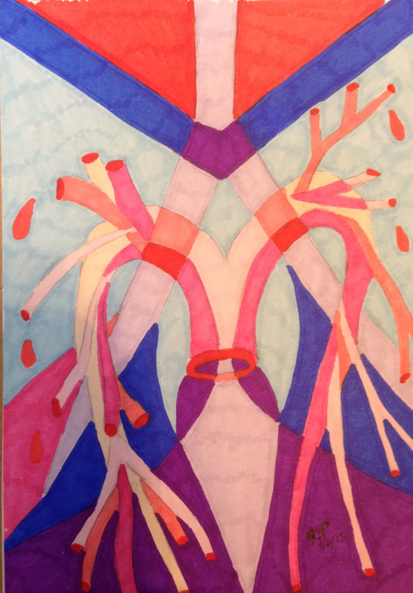 Bleeding arteries  by Jennifer C.  Pierstorff, Image 1.