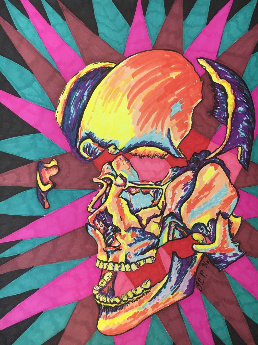 Migraine fractured skull by Jennifer C.  Pierstorff 