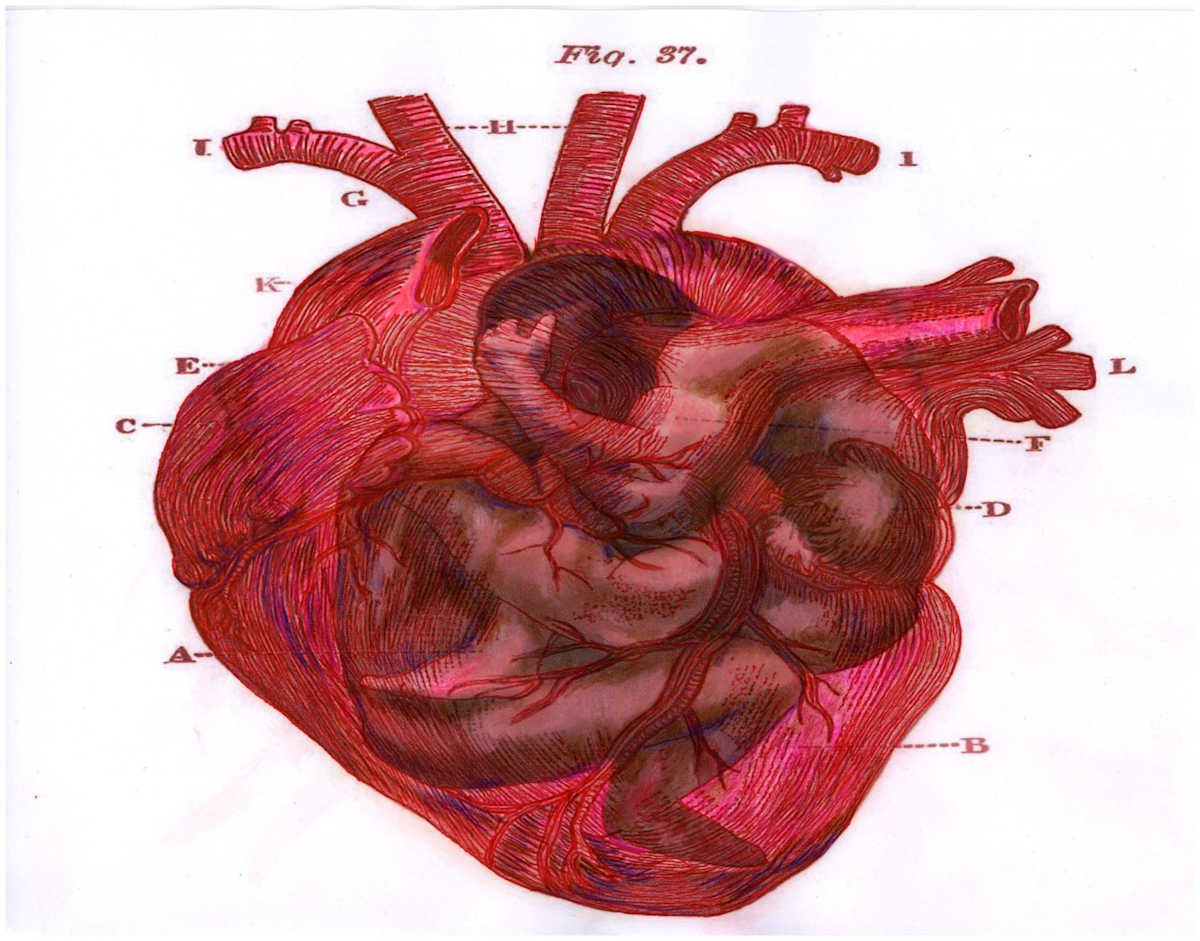 Heart Merge Excerpt 9 (From "The Anatomical Intimacy of the Heart" series) mixed media, $250.  Buyer pays shipping.  Prints available, contact artist. by Stephen Mead  Image: The series "The Anatomical Intimacy of the Heart" was published as a book, https://www.amazon.com/Anatomical-Intimacy-Heart-Stephen-Mead/dp/B0914WWJ4K