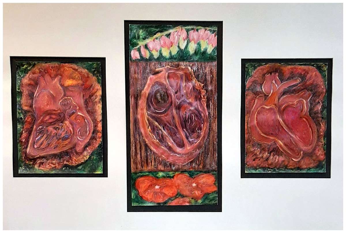 Heart Cross  (From "We Are More Than Our Wounds" series, mixed media, $375.  Buyer pays shipping, prints available, contact artist. by Stephen Mead  Image: The series "We Are More Than Our Wounds" is included in Stephen Mead's book "Selected Works", https://www.amazon.com/Selected-Works-Stephen-Mead/dp/B0D86HK7T7