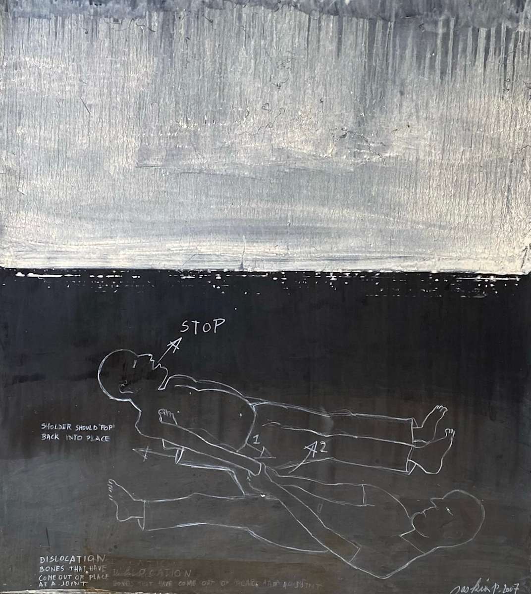 SHOULDER DISLOCATION by saskia pintelon 
