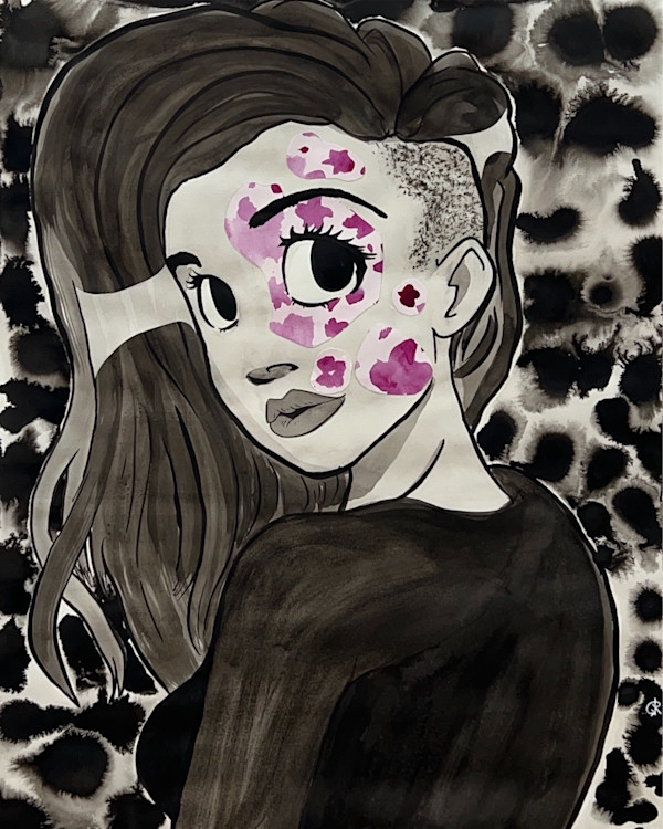 Girl with Birthmark by Ryan Barnes
