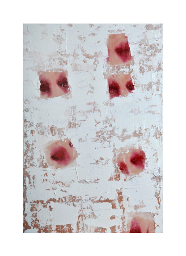 Wounds by Vincent Wolf, Image 1.