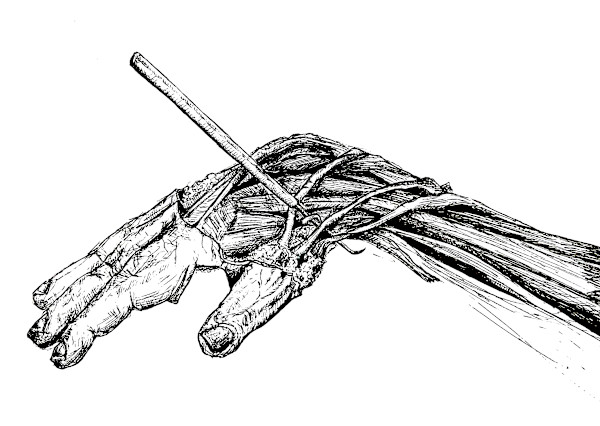 Anatomical snuffbox by Becca Lewis