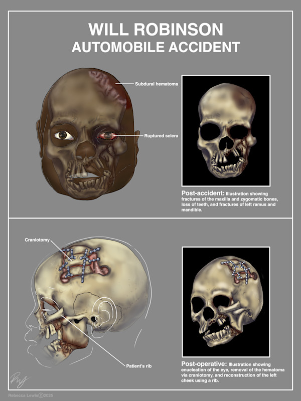 Example medical legal case by Becca Lewis