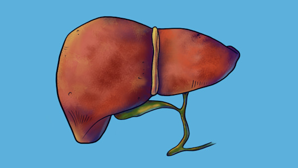 What the Hell is a Laparoscopic Cholecystectomy?? by The Art of Dissection, Image 1.