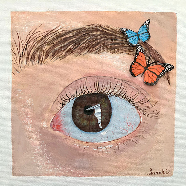 Behind The Eye by Sarah Dillon - Thyroid Eye Disease, Image 1.