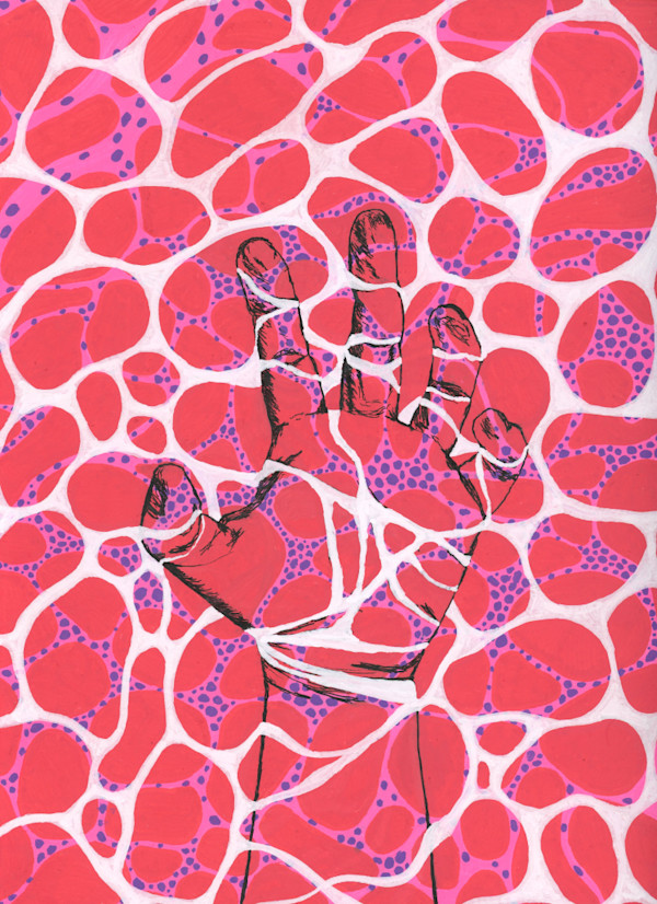 Staying Afloat With A Rare Disease by Waiyee Hui - Antisynthetase Syndrome, Image 1.
