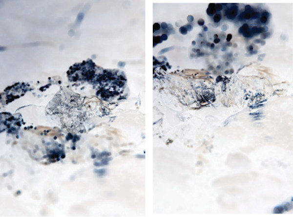 Untitled 4 (diptych from the series Glacier Ice) by Megan Major