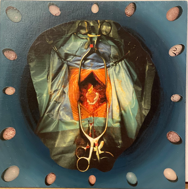 Heart Surgery by Deborah Faye Lawrence, Image 1.