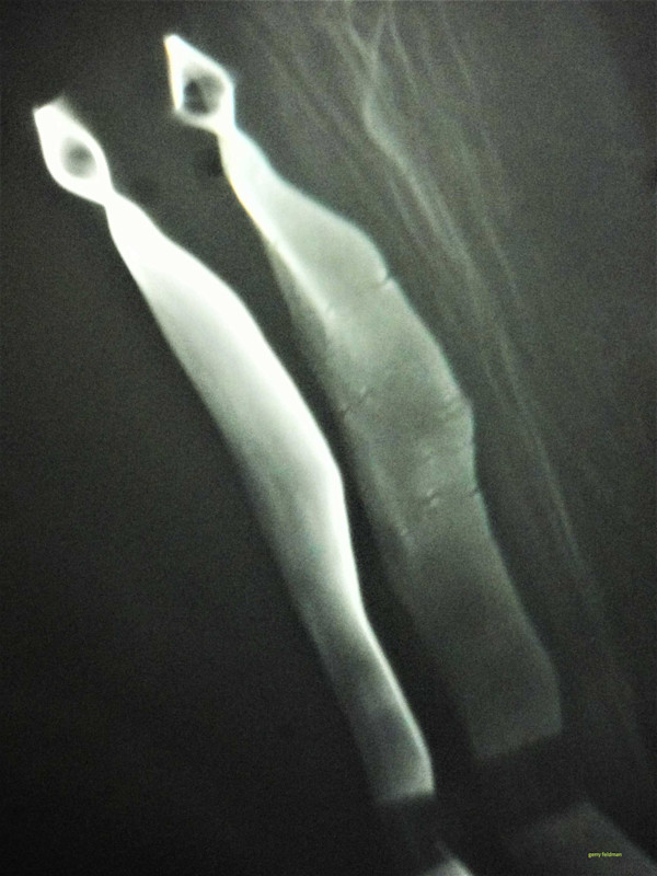 Made for Each Other by GERRY FELDMAN