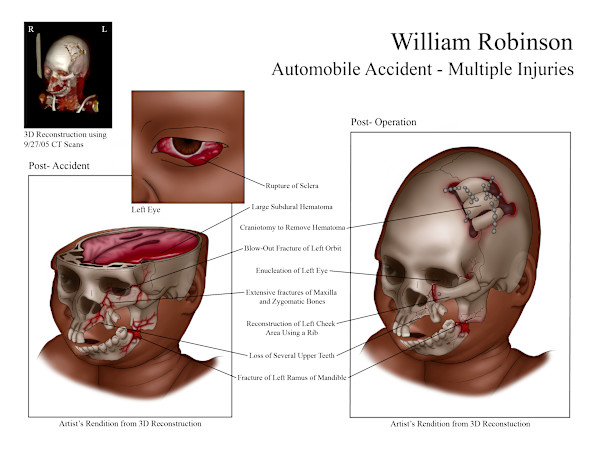 Automobile Accident by Adyson McCullough