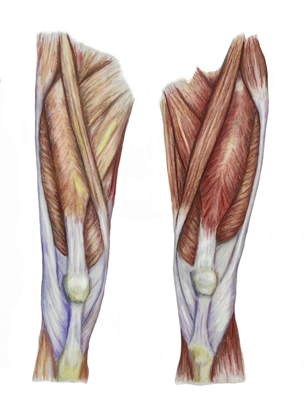 Vastus lateralis sedentary versus active by Shana Katzman, Image 1.