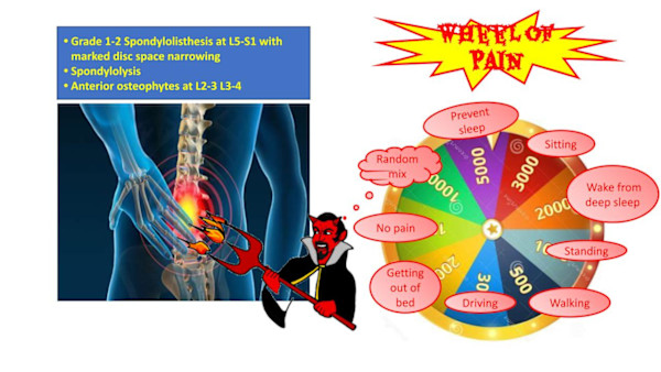 The Wheel of Pain by Nason Russ, Image 1.
