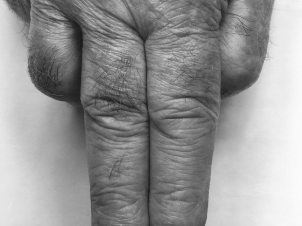 Fingers, Variant No. 12, 1999 by John Coplans