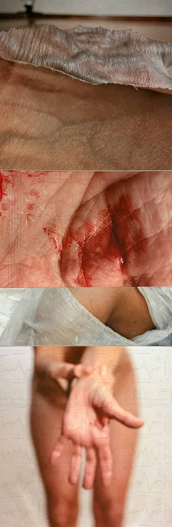 Stigma by Suzanne Gainer, Image 1.