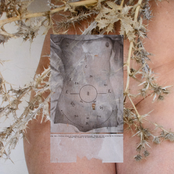 Tenderness by Suzanne Gainer, Image 1.