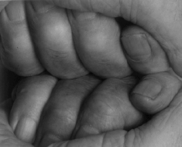 Self Portrait (Interlocking Fingers, No 15) by John Coplans