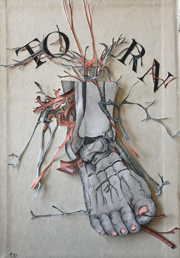 Torn Ligament by Katie McCann