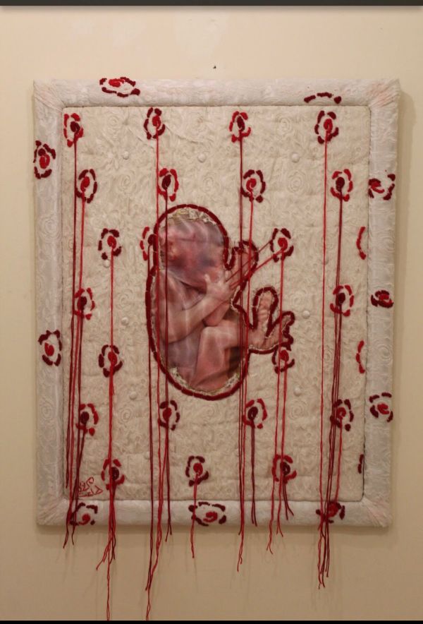 Padded Womb by Marwa Talaat