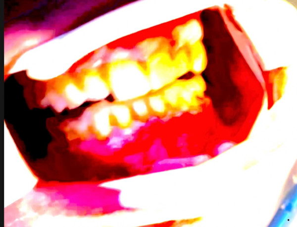 Mouthy by Kenneth Wilan, Image 1.