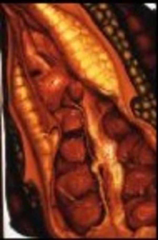 Chrysalis by Gilah Yelin Hirsch