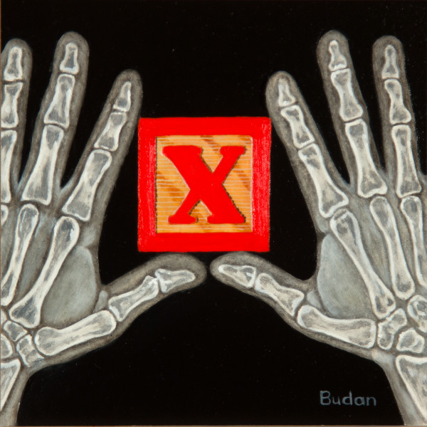 X is for X-ray by karen@karenbudan.com