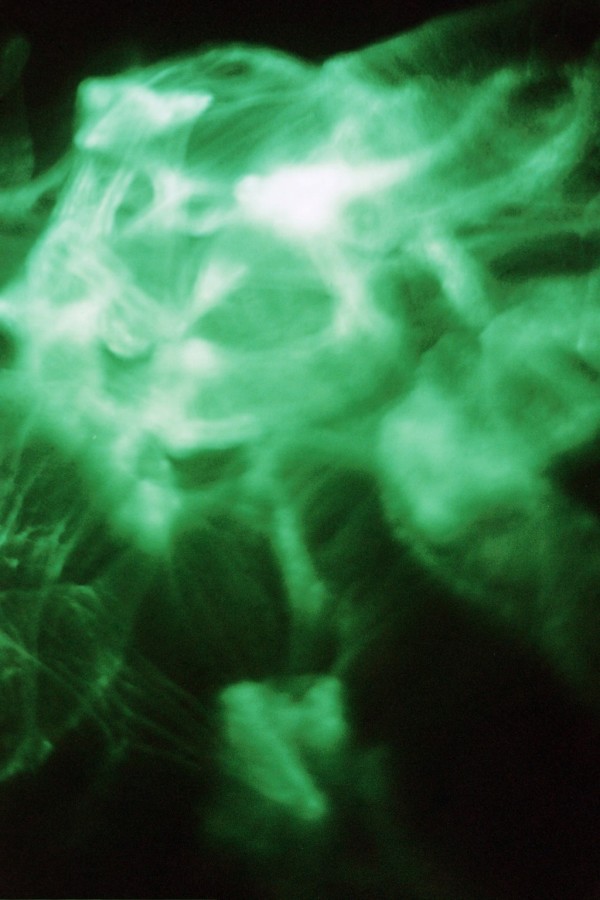 Emerald Series 2 (Masque), Image 23.