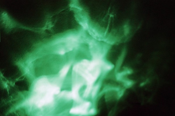 Emerald Series 3 (Scream), Image 25.